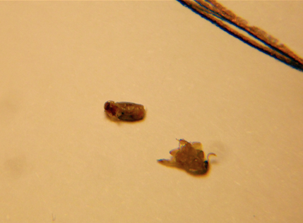 fagioli esselunga insetti 