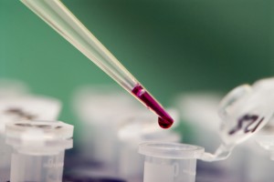 dieta, esame sangue analisi