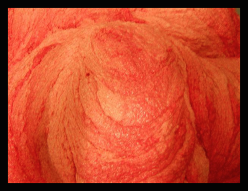 csm alta pressione efsa