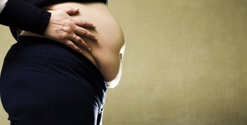 obesita donna obesa sovrappeso