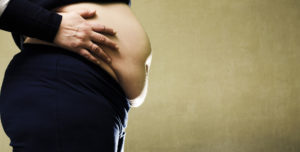 obesita donna obesa sovrappeso