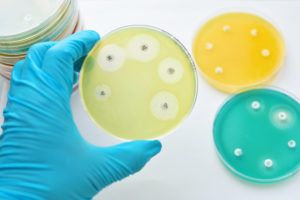 resistenza antibiotici piastre laboratorio batteri AdobeStock_105452319