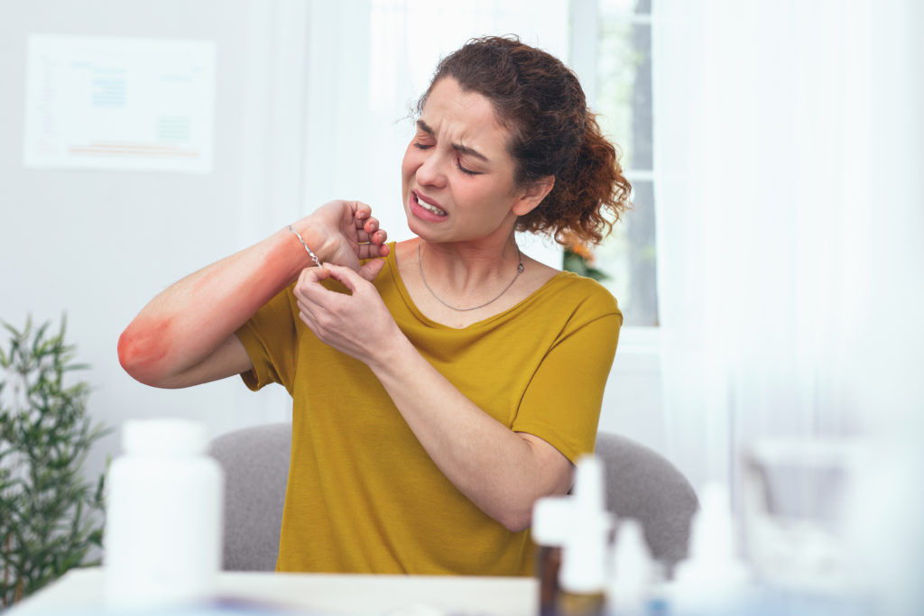 Young sore looking woman treating her inflamed arm