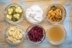 fermented food collection cibi fermentati kefir kombucha crauti kimchi microbiota